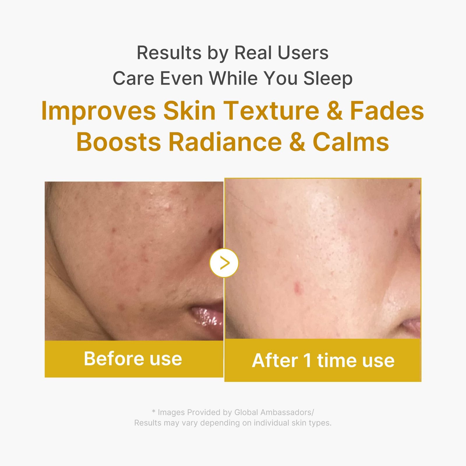 Medicube Kojic Acid Turmeric Overnight Wrapping Mask - Image 4