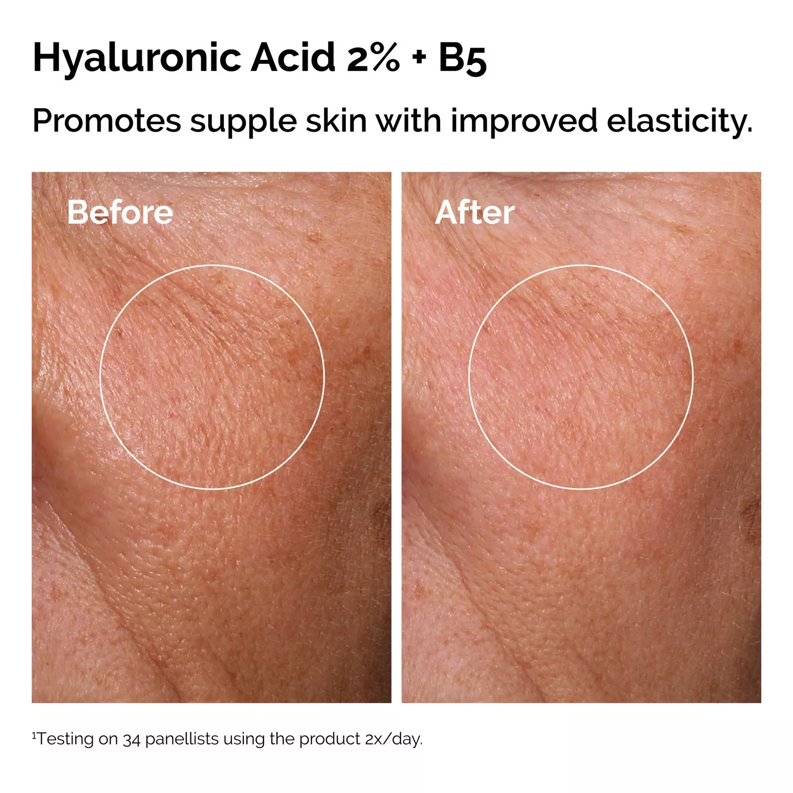 The Ordinary The Daily Set with Hyaluronic Acid Serum 3 piece Kit - Image 4